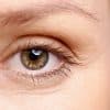 What Is The Best Under Eye Filler For Tear Troughs