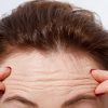 Here’s What These Seven Wrinkle Types Reveal About Who You Are